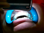 Pearly whites