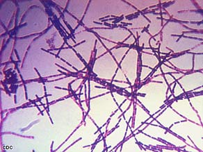 Anthrax infetions result from bacteria called Bacillus anthracis.