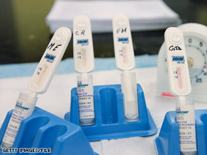 Rapid HIV test swabs incubate at the Iris House in New York in 2007.