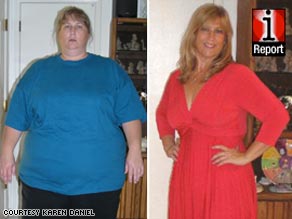 175 Pounds Lighter Woman Takes Flight Cnn Com