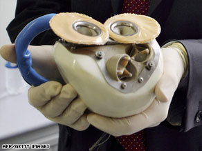 The artificial heart based on satellite and airplane technology was presented in Paris.