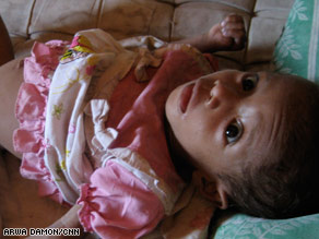 Baby Maria weighs just 10 pounds at 15 months due to malnutrition in West Timor.