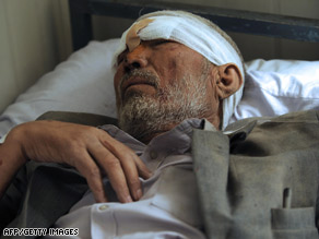 An Afghan man lies in a Kabul hospital Monday after being wounded in a suicide bomb attack.