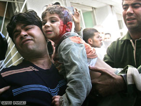 A wounded Palestinian woman lies with her baby at the Shifa hospital in Gaza City on Sunday.