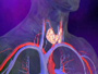 Hyperthyroidism explained