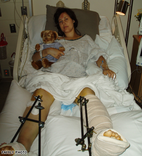 Mercedes Gorden in the hospital. She has had nine surgeries since the bridge collapse last year. 
