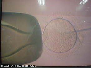 A close look at an HIV-free sperm being injected into the woman’s egg.