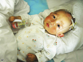 A baby suffering from kidney stones receives treatment at a hospital in Lanzhou, northwestern China's Gansu province.
