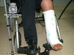 Police say the leg cast was made out of cocaine.