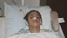 Burned boy's mom: 'It hurts'