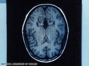 Brain Scan imagery