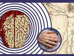 Brain scan may reveal risk for Alzheimer's disease