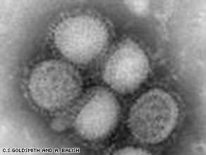 The CDC estimates more than 100,000 people have had swine flu in the United States.