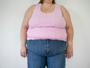 Study: Weight-loss surgery cuts cancer risk in women