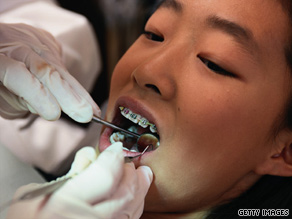 The braces don't hurt when the orthodontist puts them on, but the pressure of teeth shifting can causes achiness.