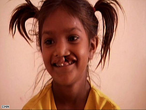 Pinki, like millions in developing countries, had to live with her deformity and suffer the social consequences.