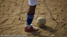 Amputees find hope in football