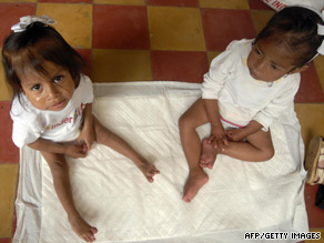 Sisters Vidalia, left, and Maribel Agustin, who suffer from malnutrition, sit at a shelter in Guatemala in August.
