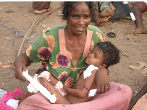 A photo supplied by a humanitarian group on Sunday shows civilians allegedly injured in government shelling.