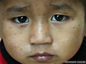 An HIV-positive Indian child at a government treatment center. More than 14,000 children get free care.