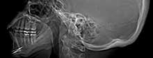 X-ray�'top modern discovery'