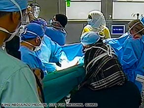 The Saudi surgical team works to separate the Egyptian twin boys.