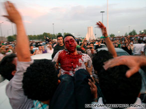 A protester injured during Monday's demonstration in Tehran is carried to a hospital.