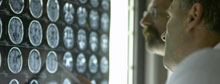 Two Alzheimer's advances