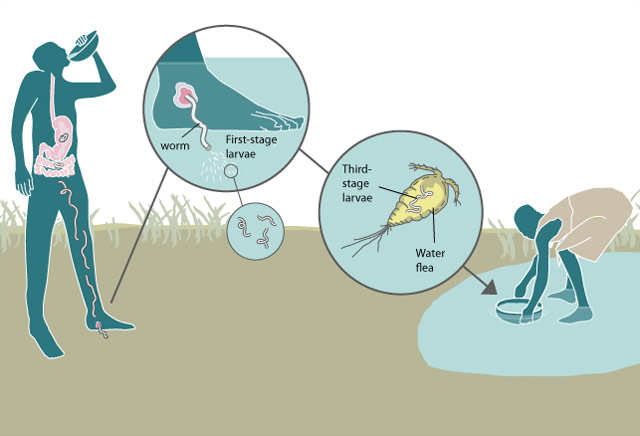 guinea worm map