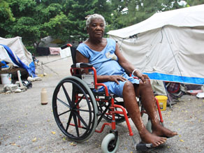 Irese Dossa, an octogenarian whose left leg was crushed by her house, then amputated, said she prays to God when it cramps up, knowing there was nothing she could do physically to alleviate the pain. Photo by Tamara Fitzpatrick