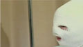 Acid attack victim: Find my attacker