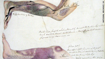 Scurvy journal