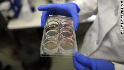 First human injected in human embryonic stem cell trial