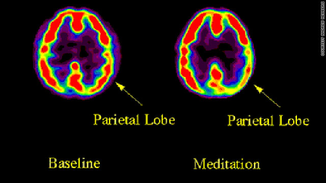 Can meditation change your brain? Contemplative neuroscientists believe it can