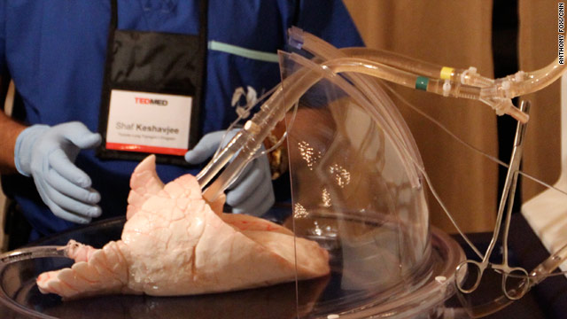 Lungs singing, breathing, and more at TEDMED