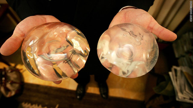Post-mastectomy, women prefer silicone implants