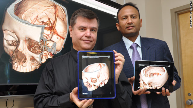 Ross Mitchell, left and Mayank Goyal display the ResolutionMD Mobile iPad app, which could help doctors diagnose strokes.