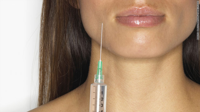 What the Yuck: Should I start Botox in my 20s?