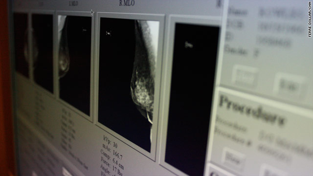 Breast cancer ID'd more accurately by docs who see more scans