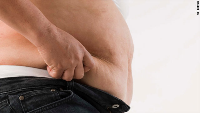 Riskier weight loss surgery gets results
