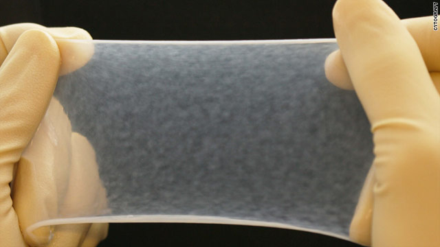 Engineers create human blood vessels from skin cells