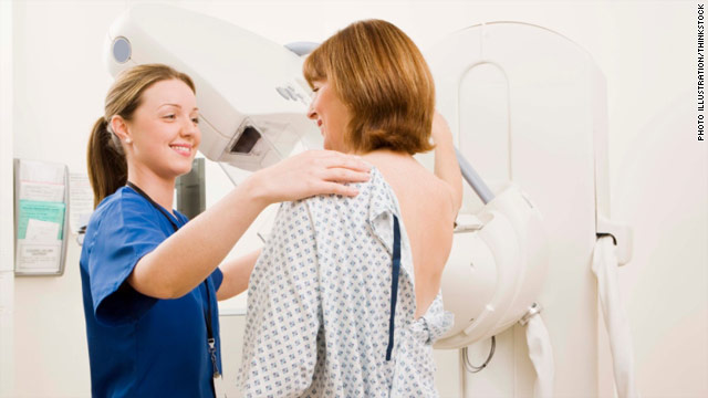 Docs group urges mammograms every year starting at 40