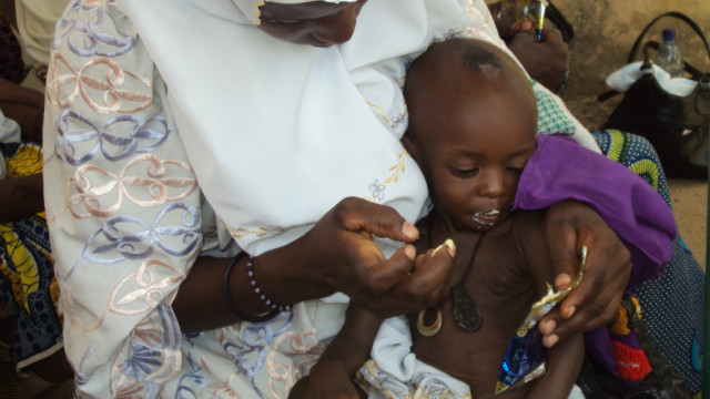 The funny sounding nut paste that's saving children's lives in Somalia