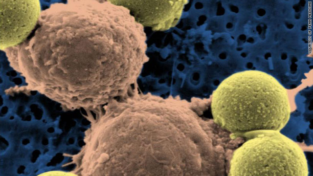 'Serial killer' cells can target leukemia, study says