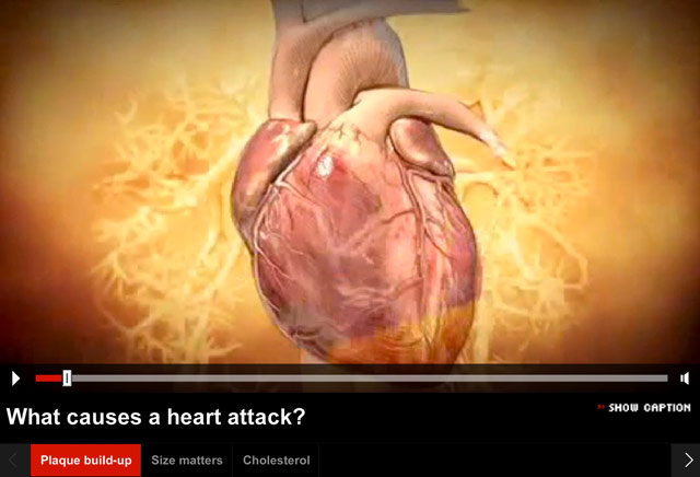 Average Cholesterol Level Of Heart Attack Victim Diet