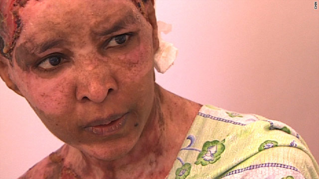 Scalded nanny to Gadhafi's grandchildren getting hospital treatment