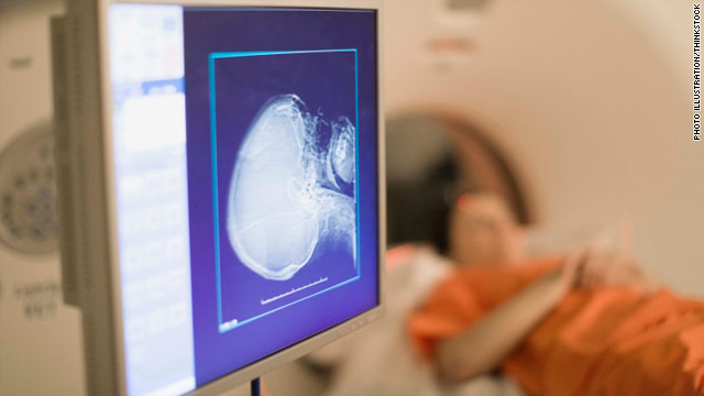 Researchers closer to developing a ‘pain-o-meter’