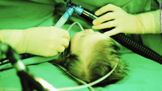 Anesthesia use in kids linked to learning disabilities