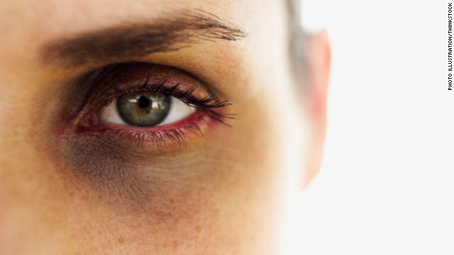 Survey: 1 in 3 women affected by partner's violent behavior