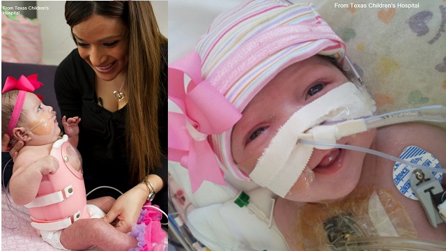 Tonight on AC360: Baby Audrina defies the odds